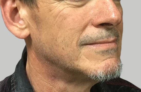man's face with wrinkles