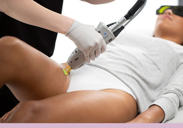 young woman receiving laser hair removal treatment on legs