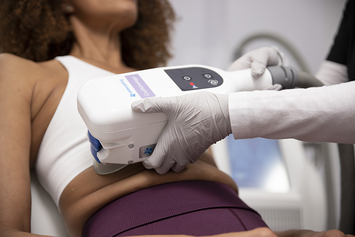 Woman receiving CoolSculpting treatment on stomach administered by an Ideal Image Medical Professional.